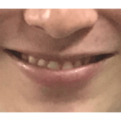 先っちょにティッシュついてる時ない？